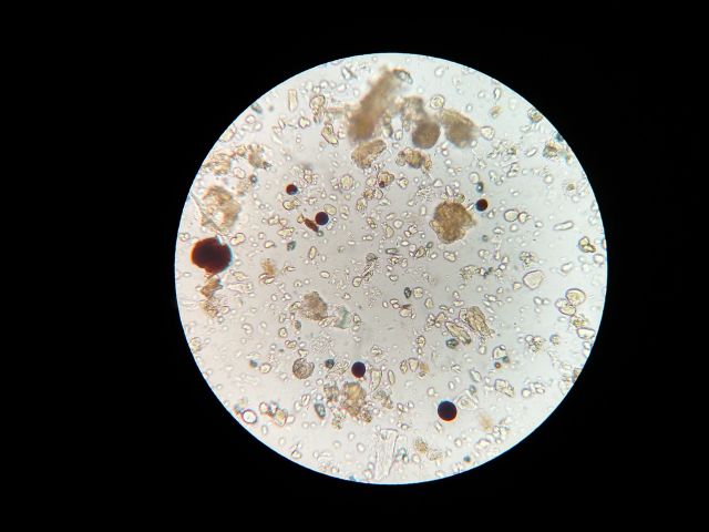 Soil microbes 1802199 1920 pixabay