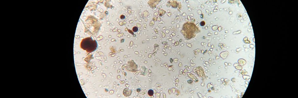 Soil microbes 1802199 1920 pixabay